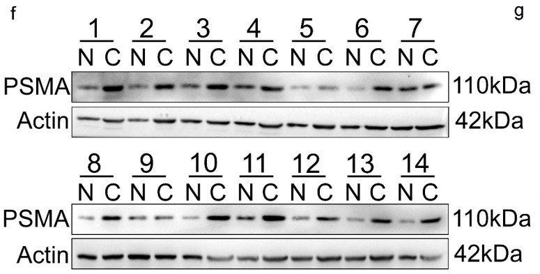 The expression of PSMA in PCa tissues was detected by Western blotting.jpg